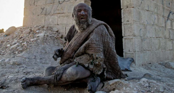 Умер самый грязный человек в мире: иранский отшельник перестал мыться 60 лет назад
